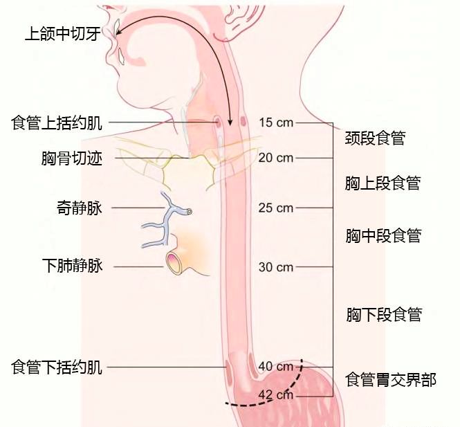 食管癌 TNM 分期，你真的掌握了嗎？